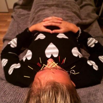 MsMMango - Cosmetic Acupuncture 2