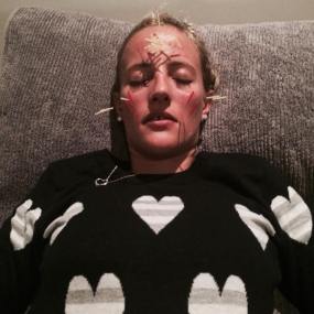 MsMMango - Cosmetic Acupuncture 3