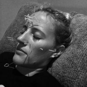 MsMMango - Cosmetic Acupuncture 1